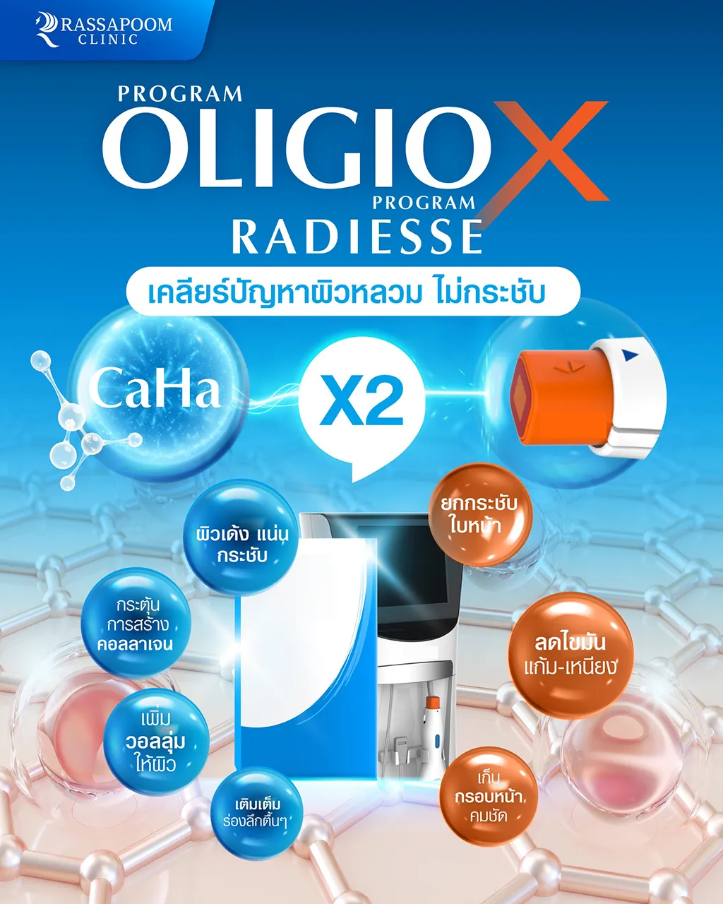 โปรแกรม #OligioX โปรแกรม #Radiesse เคลียร์ผิวหลวม ไม่กระชับ x2