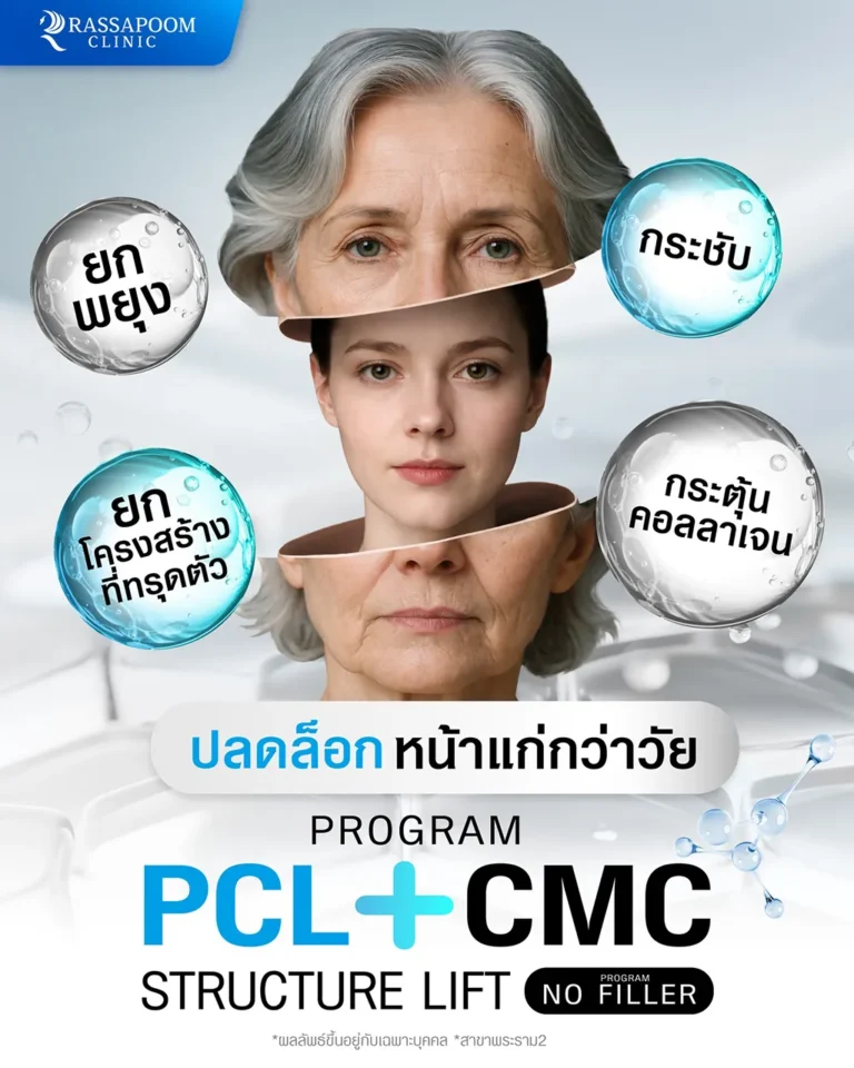 ปลดล็อกหน้าแก่กว่าวัย ด้วยโปรแกรม PCL + CMC STRUCTURE LIFT