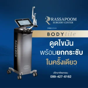 ดูดไขมันหน้าท้องด้วยโปรแกรม BodyTite