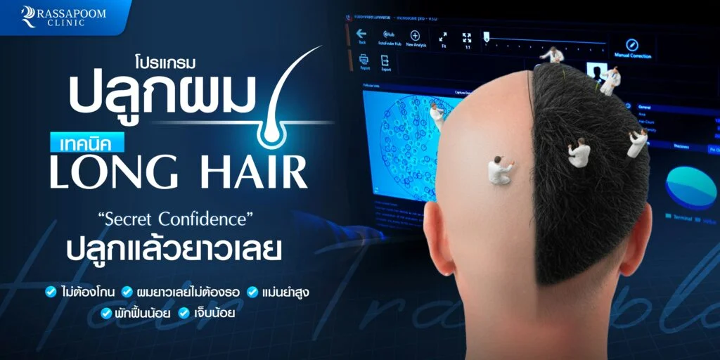 โปรแกรมปลูกผมด้วยเทคนิค Long Hair (Non – Shaven FUE)