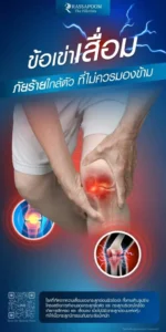 โปรแกรมรักษาข้อเข่าเสื่อม Knee Osteoarthritis