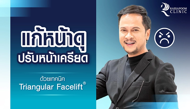 แก้ปัญหาหน้าดุปรับหน้าเครียด ด้วยเทคนิค Triangular Face Lift (คุณแช่ม แช่มรัมย์)